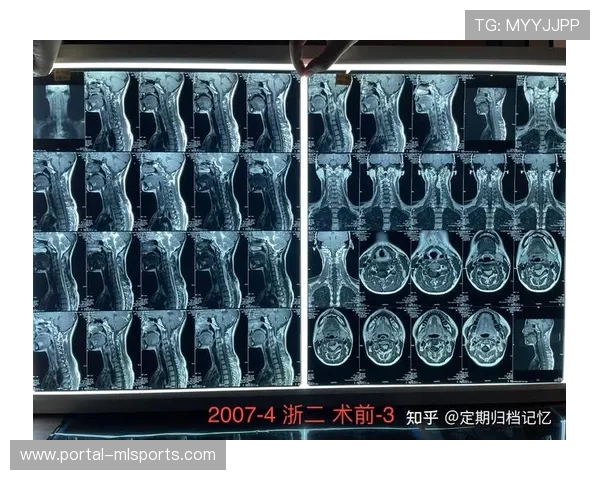 风间敏晨臣CT扫描显示头颈无结构性损伤,当晚出院 风间敏晨臣CT扫描显示头颈无结构性损伤,当晚出院